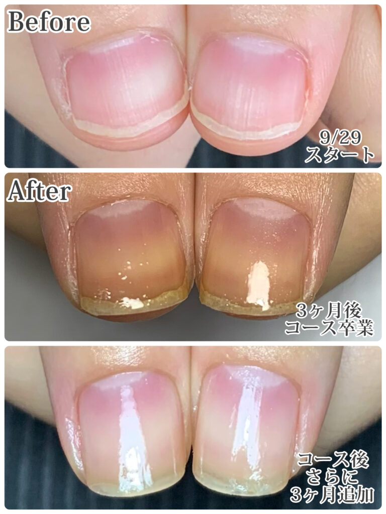 所沢ネイルサロン 自爪育成ネイルケア専門店 ルチア Just Another Wordpress Site