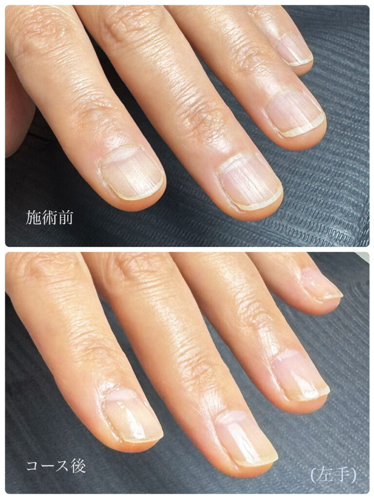 所沢ネイルサロン｜自爪育成ネイルケア専門店｜ルチア