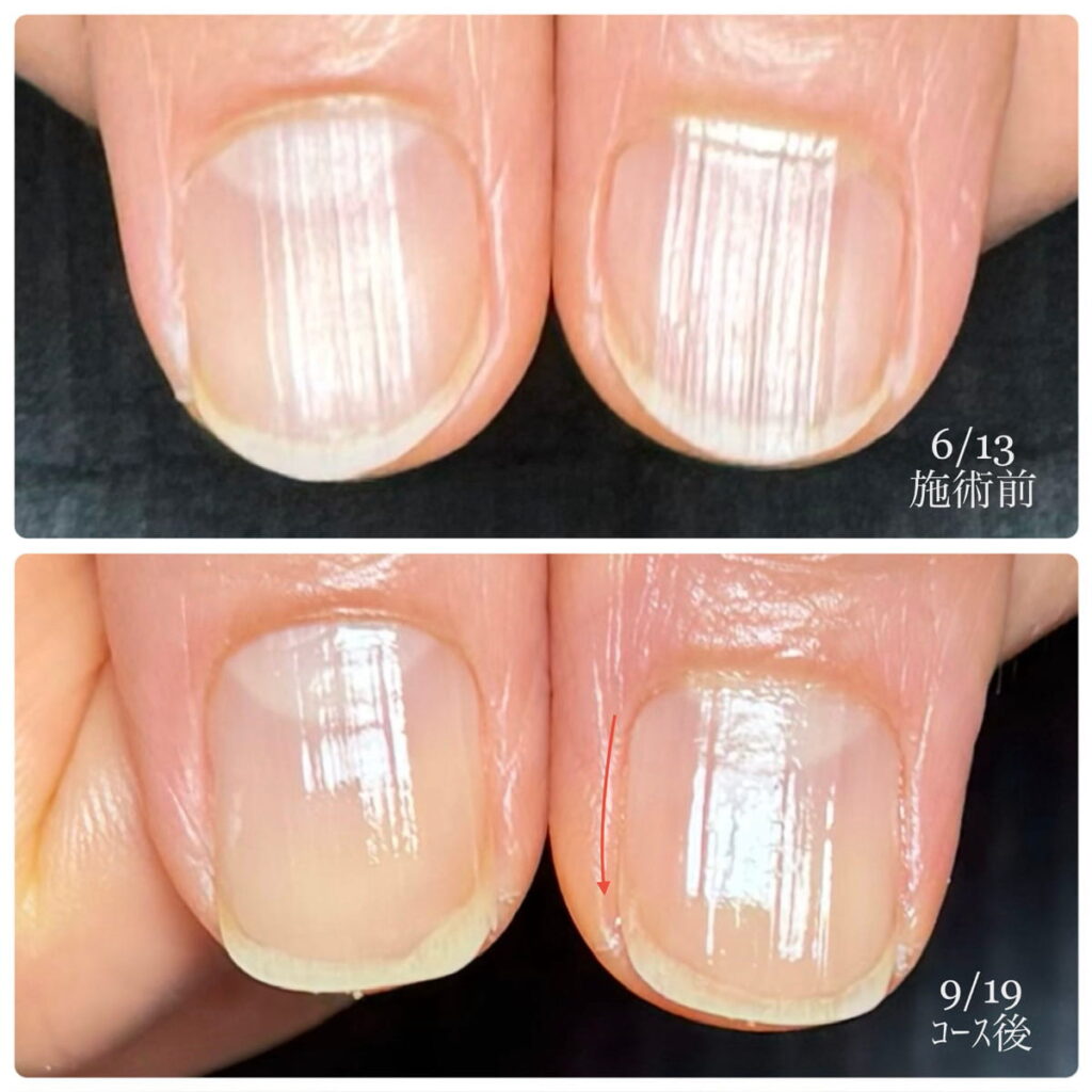 所沢ネイルサロン｜自爪育成ネイルケア専門店｜ルチア