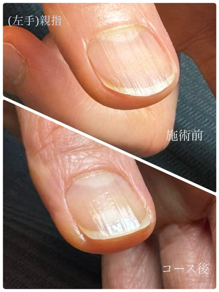 所沢ネイルサロン｜自爪育成ネイルケア専門店｜ルチア