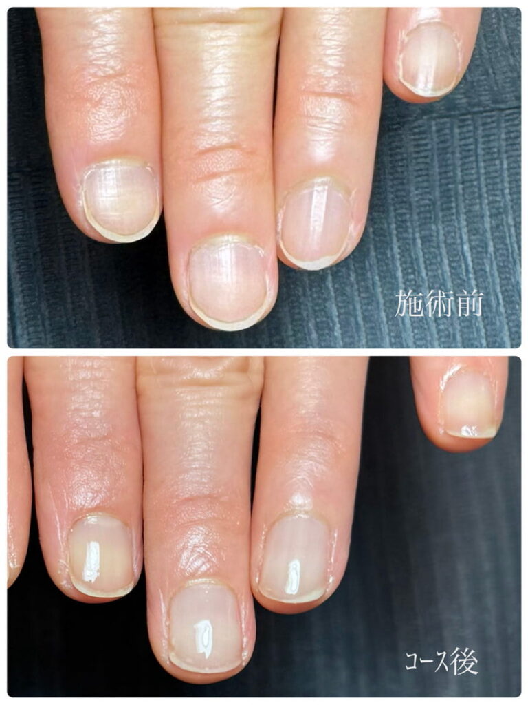 所沢ネイルサロン｜自爪育成ネイルケア専門店｜ルチア